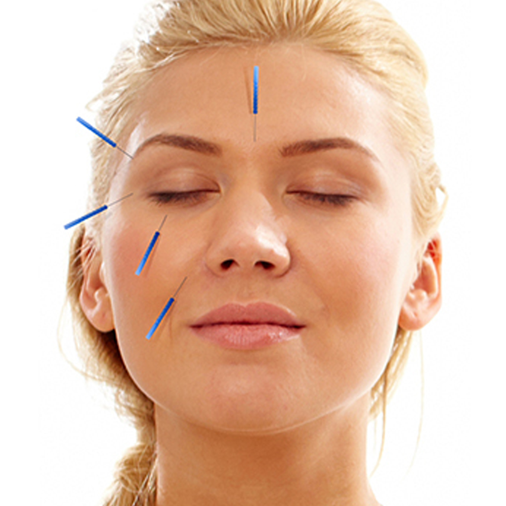 Facial Acupuncture