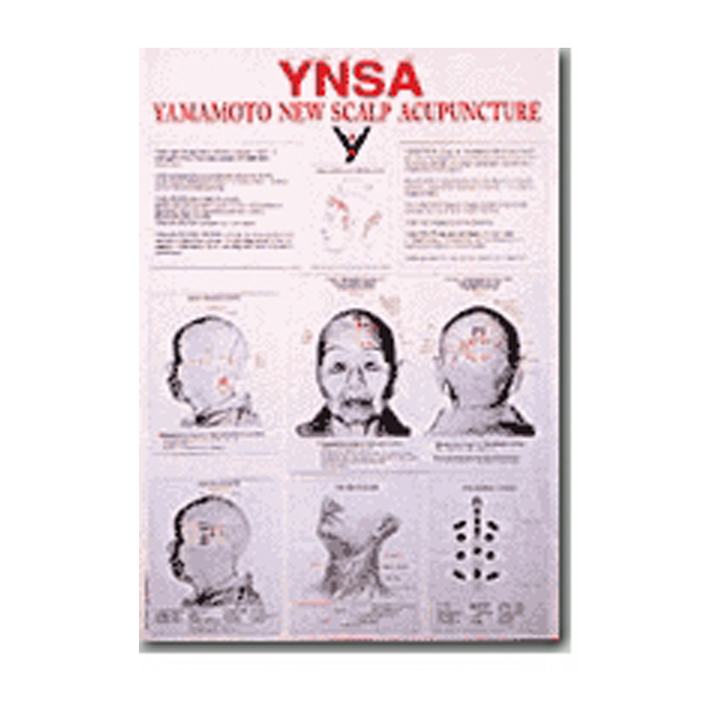 Yamamoto New Scalp Acupuncture Chart