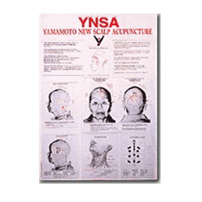 Yamamoto New Scalp Acupuncture Chart